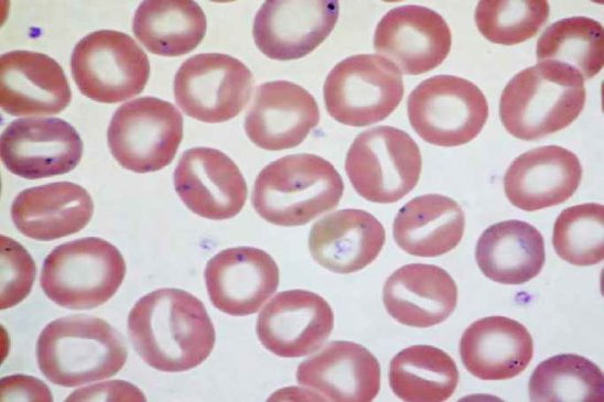 سلول‌های دهانی شکل Stomatocytes