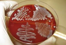 Photo of کشت باکتری‌ها