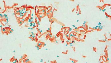 Photo of رنگ‌آمیزی اسپور باکتری‌ها